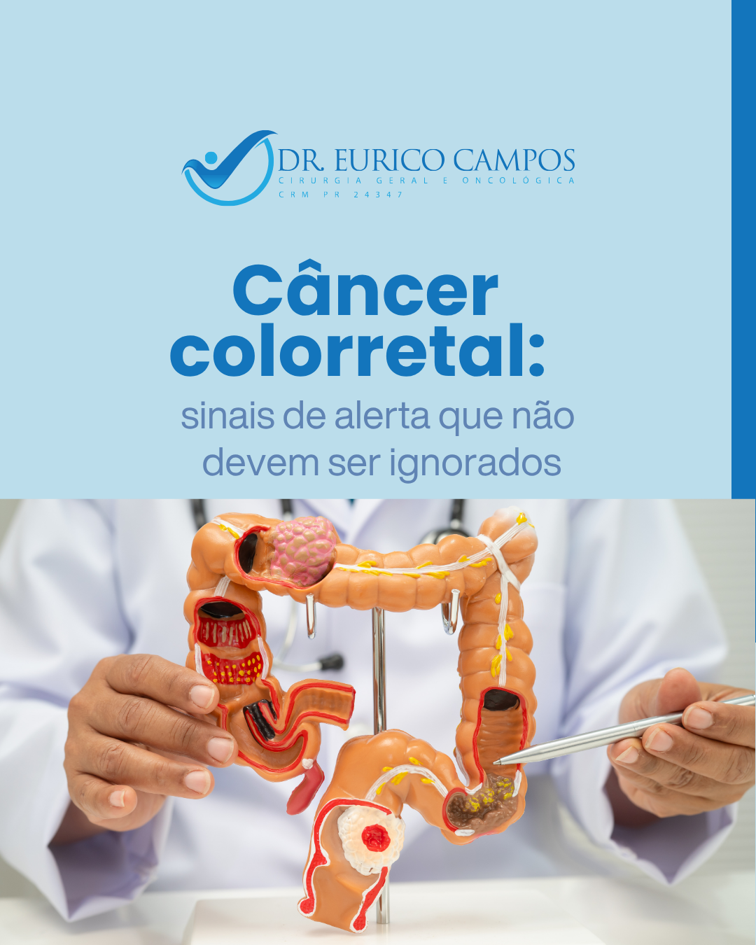 Câncer colorretal: sinais de alerta que não devem ser ignorados
