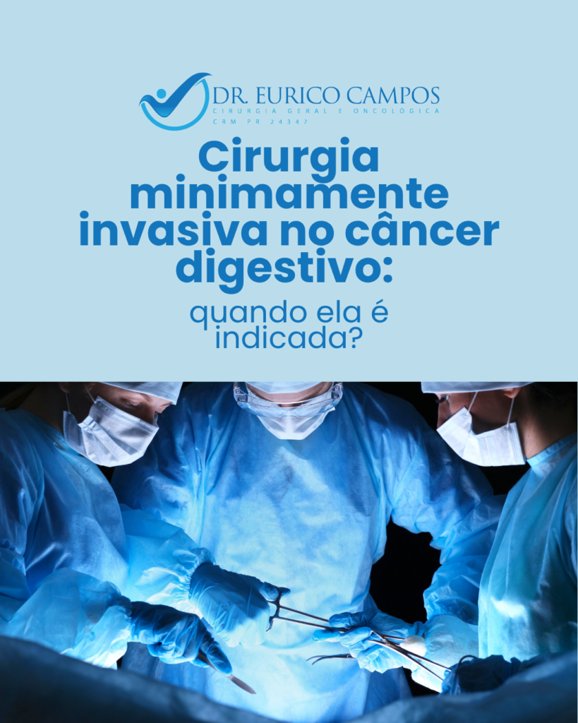 Cirurgia minimamente invasiva no câncer digestivo: quando ela é indicada?